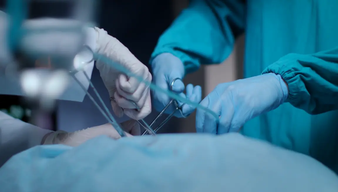 20 Surgery Quiz Questions and Answers