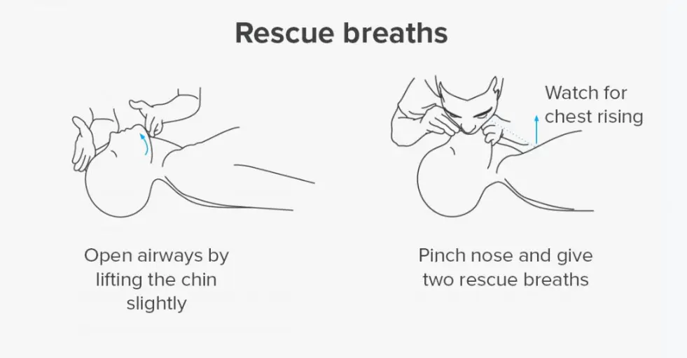 20 Rescue Breaths Quiz Questions and Answers