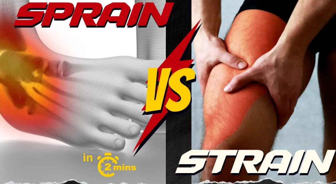 20 Sprains and Strains Quiz Questions and Answers